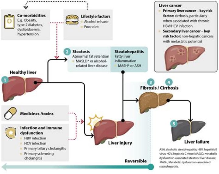 Does niacin cause elevated liver enzymes