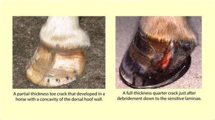 What is a quarter crack in a horses hoof