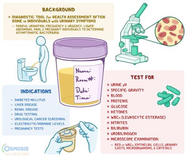 What is cytology urine test for