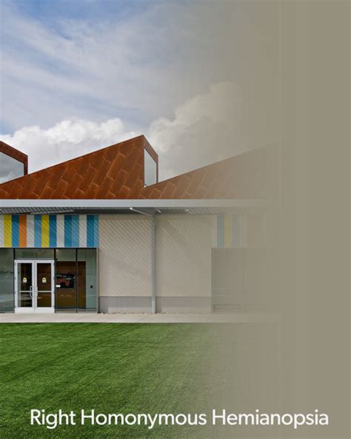 What is right sided homonymous Hemianopsia