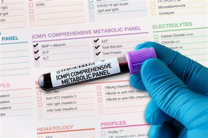 What labs are in a comprehensive metabolic panel
